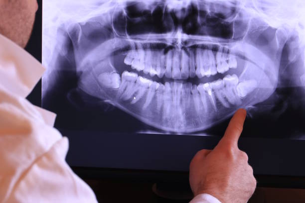 Best Emergency Root Canal Treatment in Rock Hill, MO