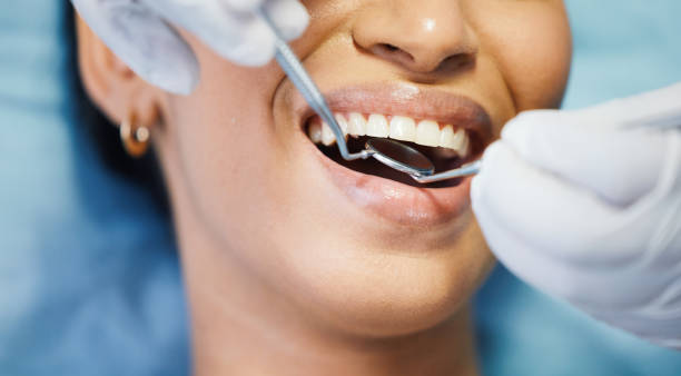 Best Same-Day Emergency Dentist in Rock Hill, MO