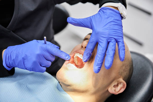 Best Emergency Treatment for Toothache in Rock Hill, MO